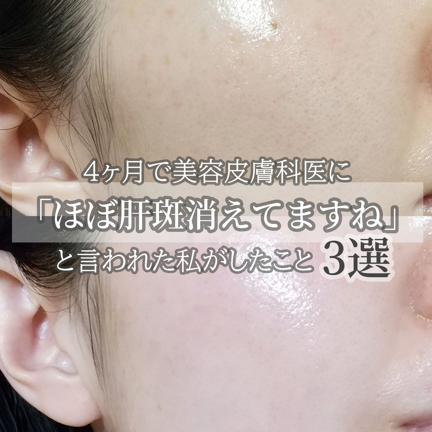 ハイドロクリームPHQ-5/KISO/フェイスクリームを使ったクチコミ(1枚目)