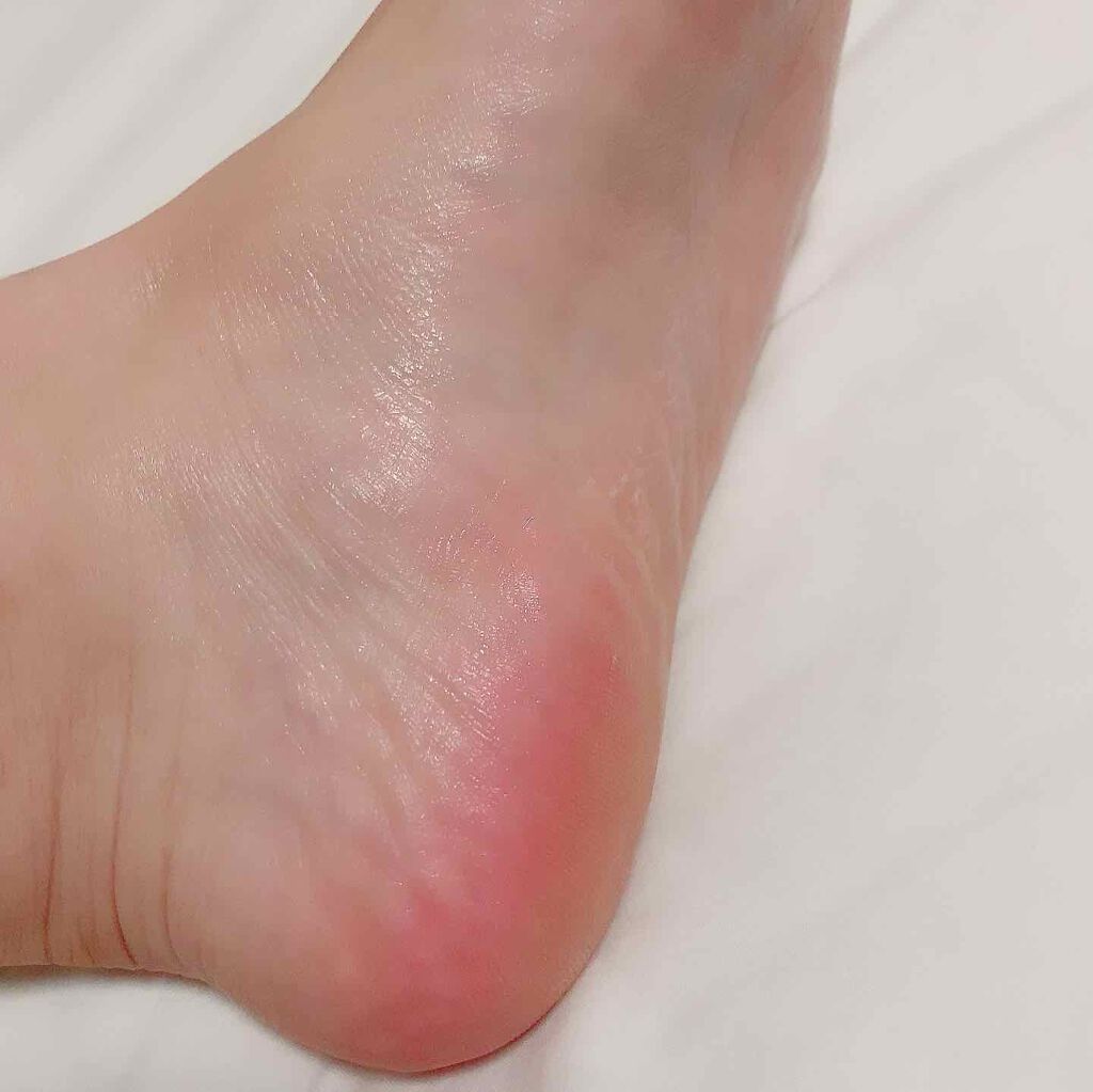 mayukoro on LIPS 「『Dr.Scholl(ドクターショール)足用集中保湿パック』し..」(5枚目)