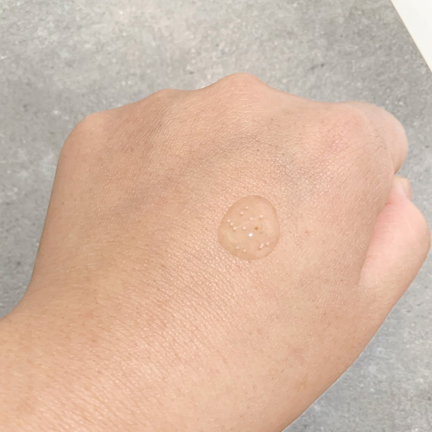 くらもちになったゆか on LIPS 「鎮静作用のあるツボクサエキスを配合したアンプル低刺激なので敏感..」(2枚目)