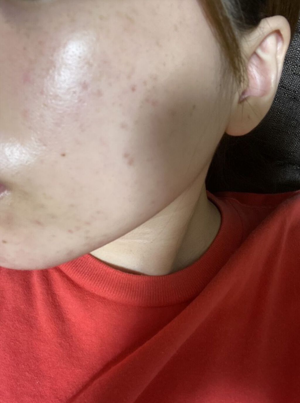 ブライト＆バウンシングローション（ノーマルタイプ）/ジュレリッチ/化粧水を使ったクチコミ（3枚目）