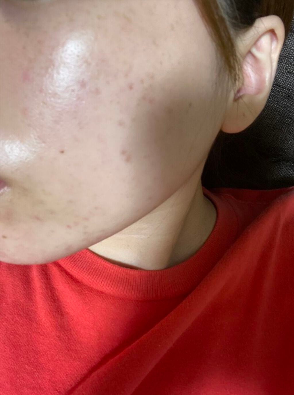 メディカルクリームG(薬用クリームG)/メンターム/ハンドクリームを使ったクチコミ(3枚目)