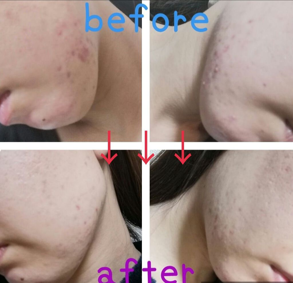 CICA クリーム/VT/フェイスクリームを使ったクチコミ（2枚目）