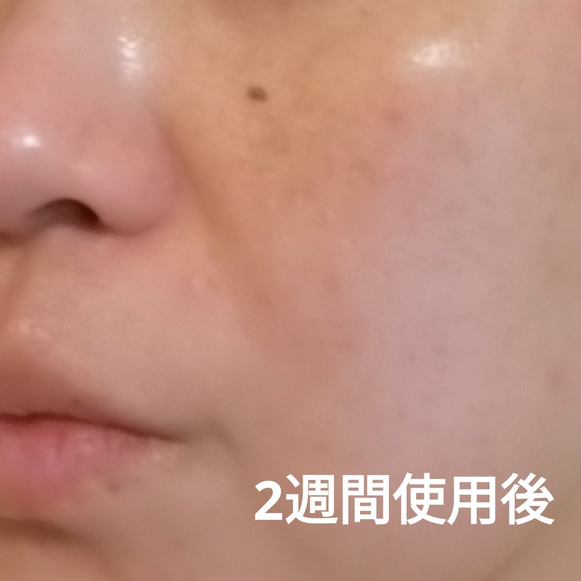 PDRNショット675/COSNORI/美容液を使ったクチコミ(4枚目)