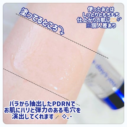 å¹åð* :ïŸ on LIPS ããããã æ¯ç©Žã®åŒãç· ãã«ðªâ¡.·ããããã¢ã³ãã«ð©·/âããâïž..ãïŒ4æç®ïŒ