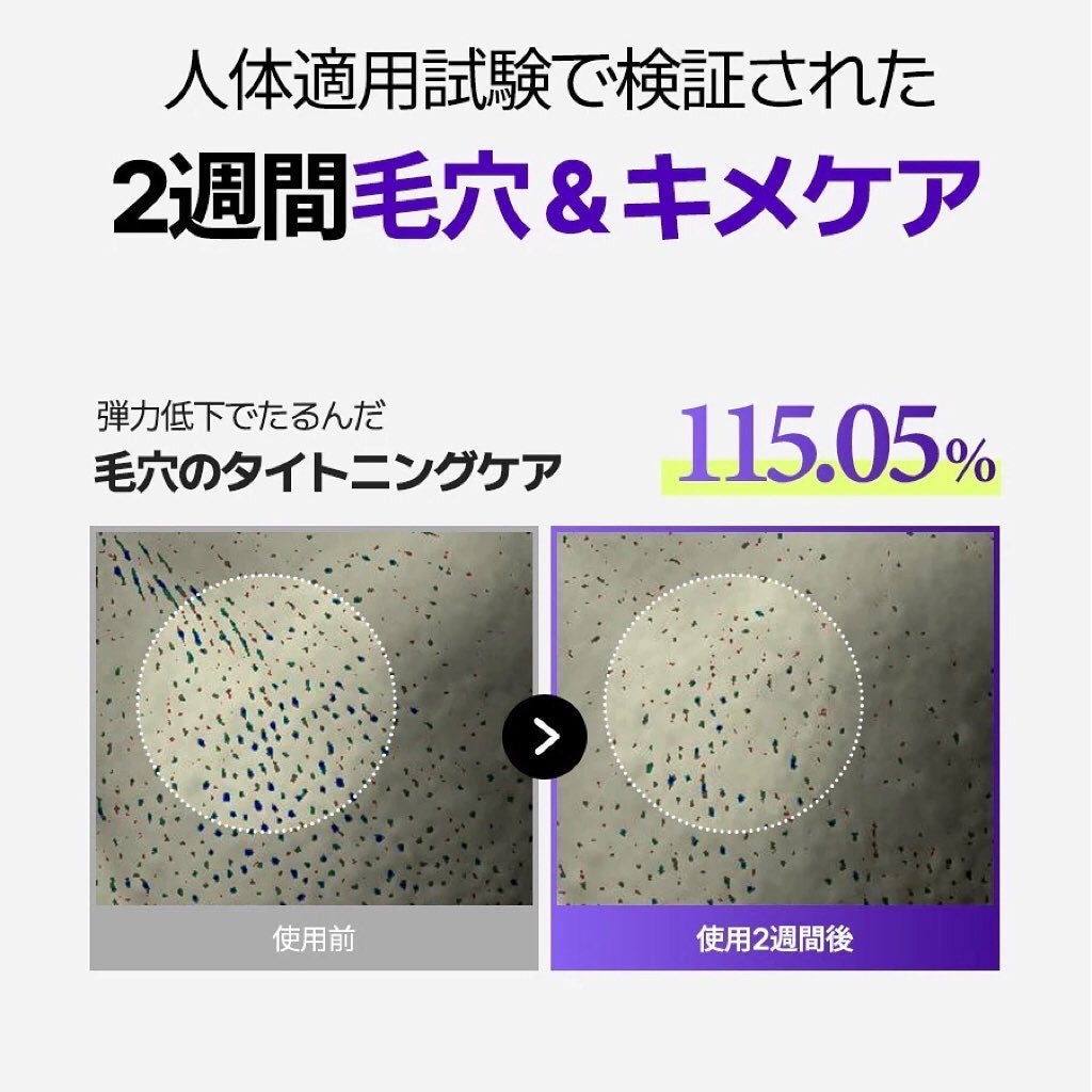オニオン ニューペア スポットパッチ ベーシック/Isntree/にきびパッチを使ったクチコミ(6枚目)