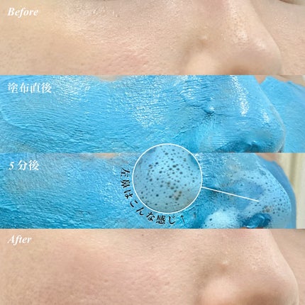 ゼロ毛穴クレイパック/MEDICUBE/洗い流すパック・マスクを使ったクチコミ(4枚目)