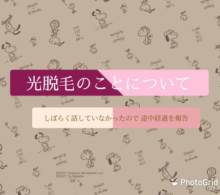 bi-hada ompa L ホルダー替刃2個付/貝印/シェーバーを使ったクチコミ(1枚目)