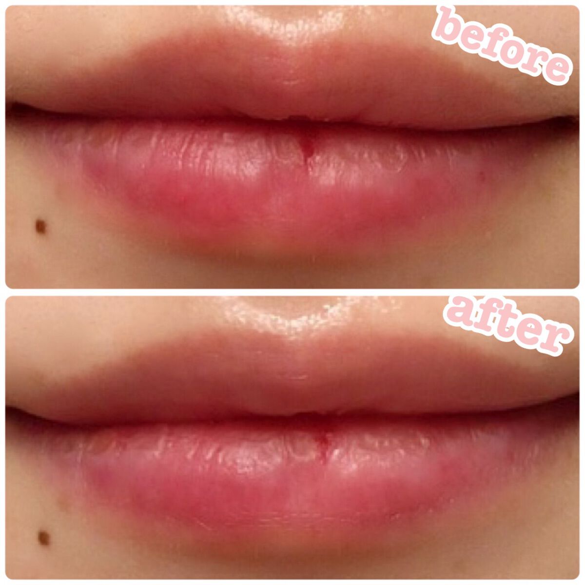 リップパック	 バニラ/CHOOSY/リップマスクを使ったクチコミ（3枚目）