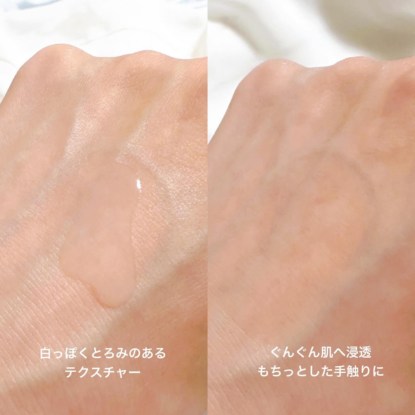 ヴィーガンリポソームレチノールセラム/SKIN&LAB/美容液を使ったクチコミ（3枚目）