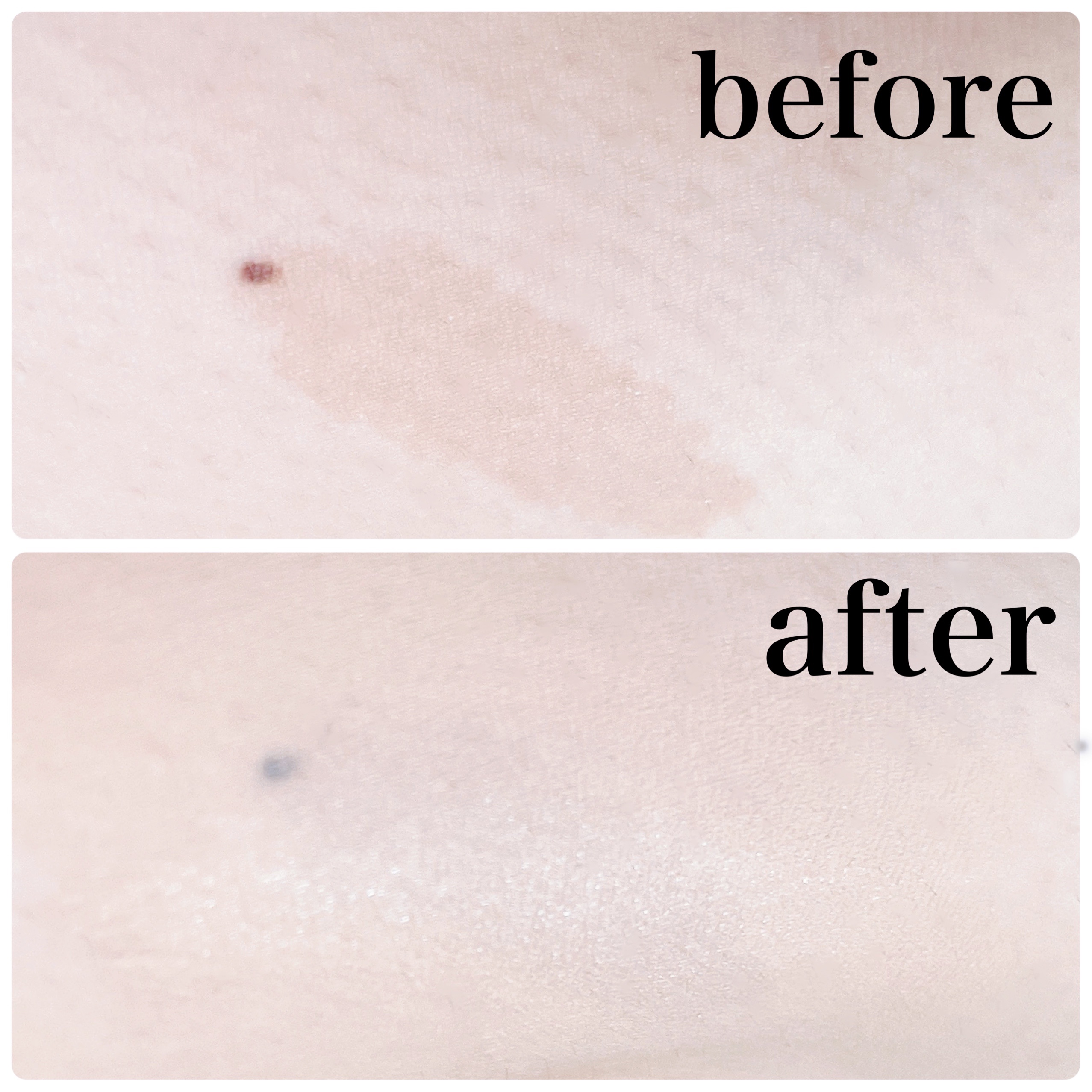 マーシュフィールド SC ボディカバーファンデN/マーシュ・フィールド/クリーム・エマルジョンファンデーションを使ったクチコミ（3枚目）