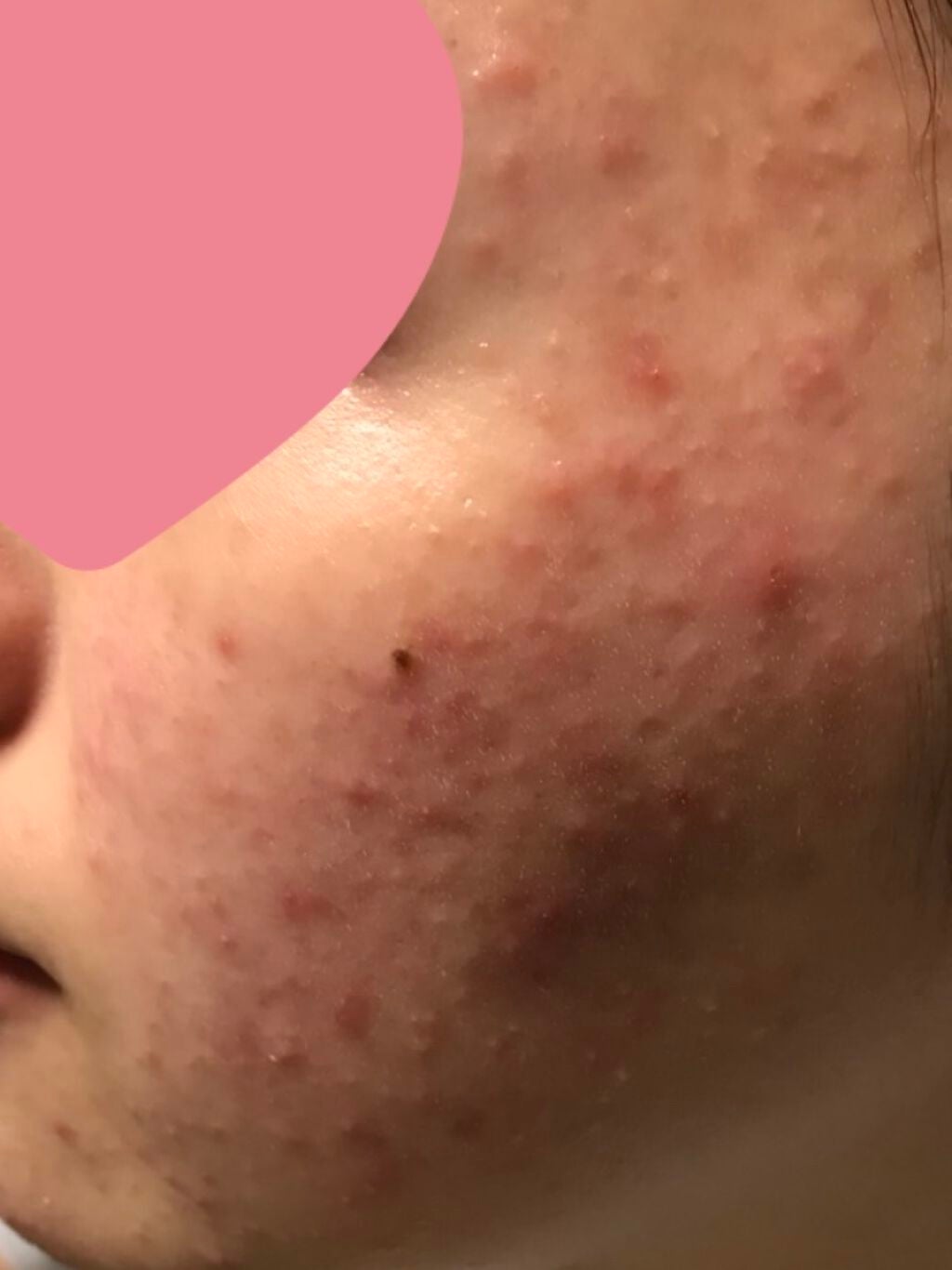 UVミルクEX/NOV/日焼け止めミルクを使ったクチコミ(1枚目)