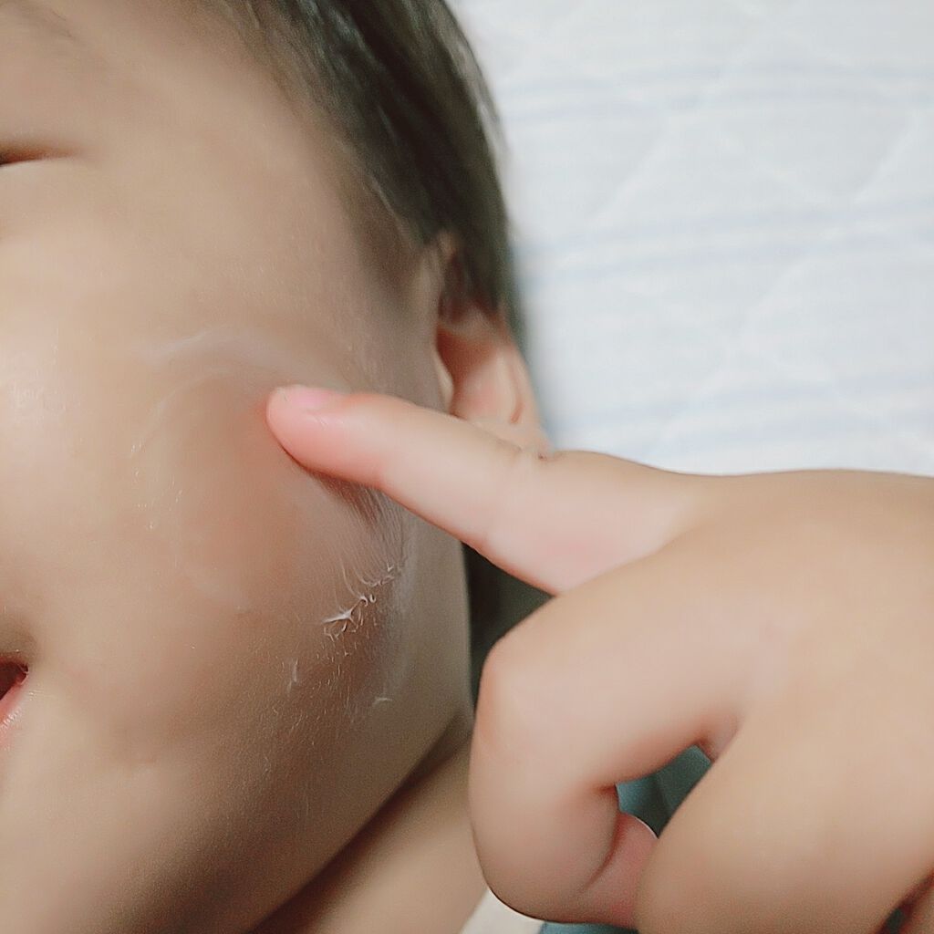 セラミエイド 薬用スキンクリーム/セラミエイド/フェイスクリームを使ったクチコミ(2枚目)