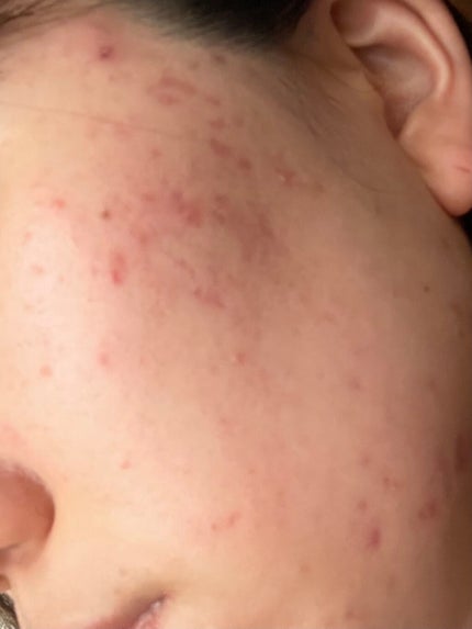 を使ったクチコミ(2枚目)