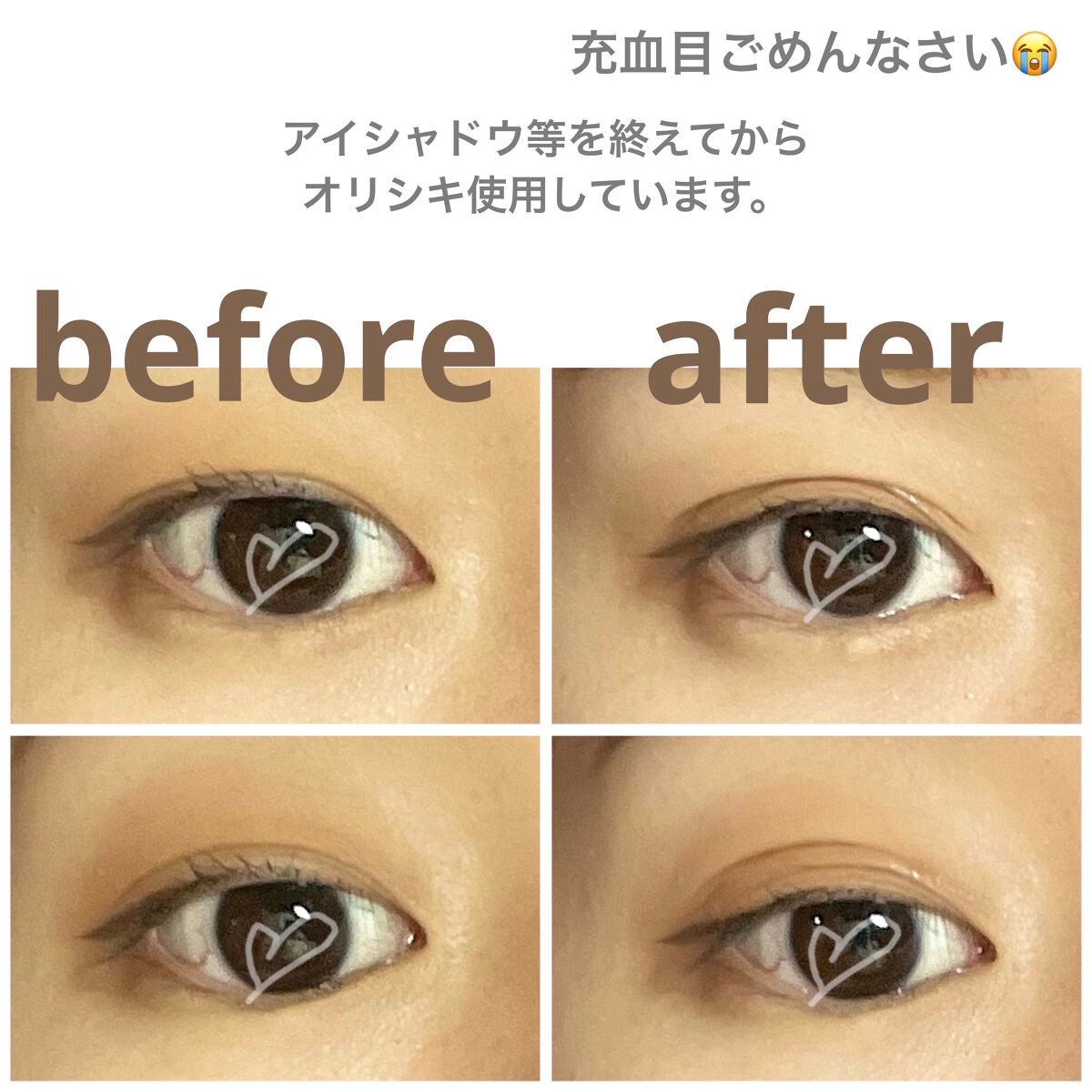 オリシキ アイリッドスキンフィルム /D-UP/二重まぶた用アイテムを使ったクチコミ(4枚目)