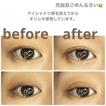 オリシキ アイリッドスキンフィルム /D-UP/二重まぶた用アイテムを使ったクチコミ(4枚目)