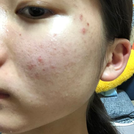 ハトムギ化粧水(ナチュリエ スキンコンディショナー R )/ナチュリエ/化粧水を使ったクチコミ(1枚目)