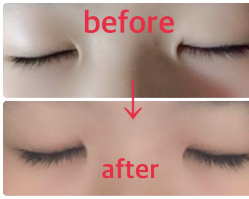 オリジナル ピュアスキンジェリー/ヴァセリン/ボディクリームを使ったクチコミ（2枚目）