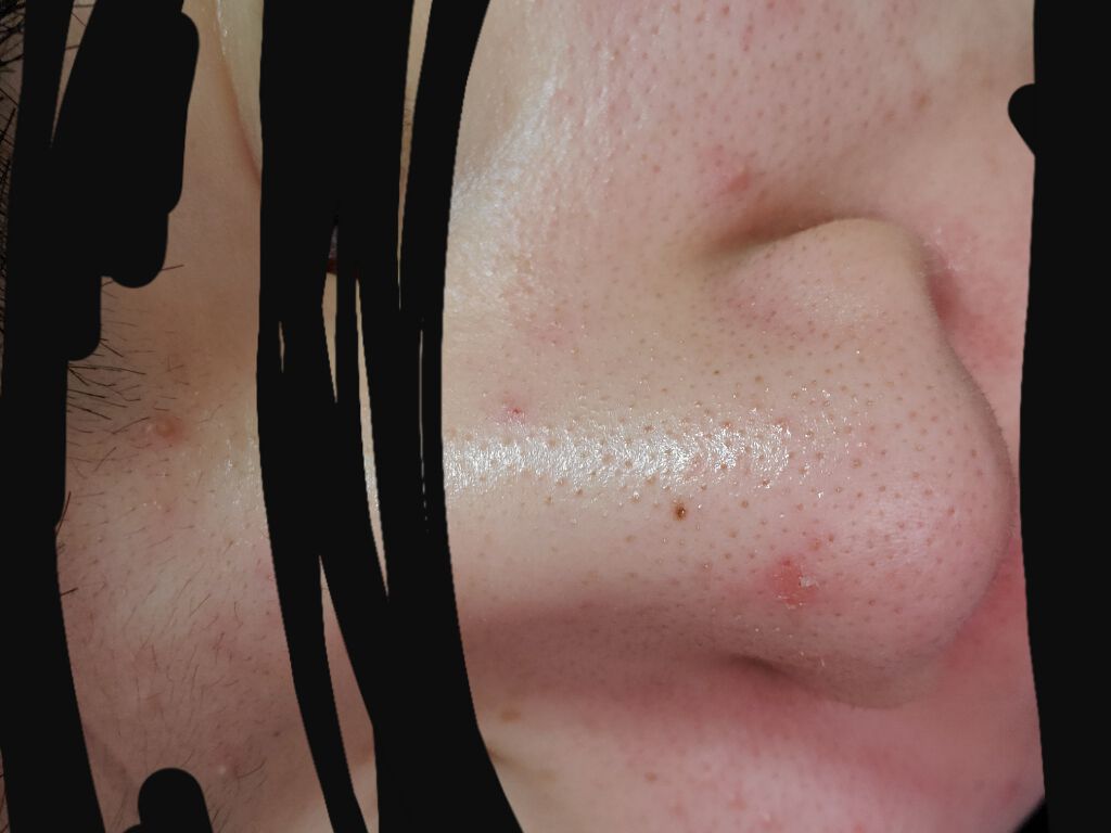 りお on LIPS 「こんにちわ中学三年生のりおです。最近コロナが流行ってどこへ行く..」(4枚目)