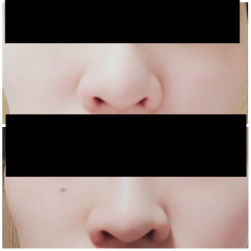 ノーズトレーナー/DAISO/その他スキンケアグッズを使ったクチコミ（2枚目）