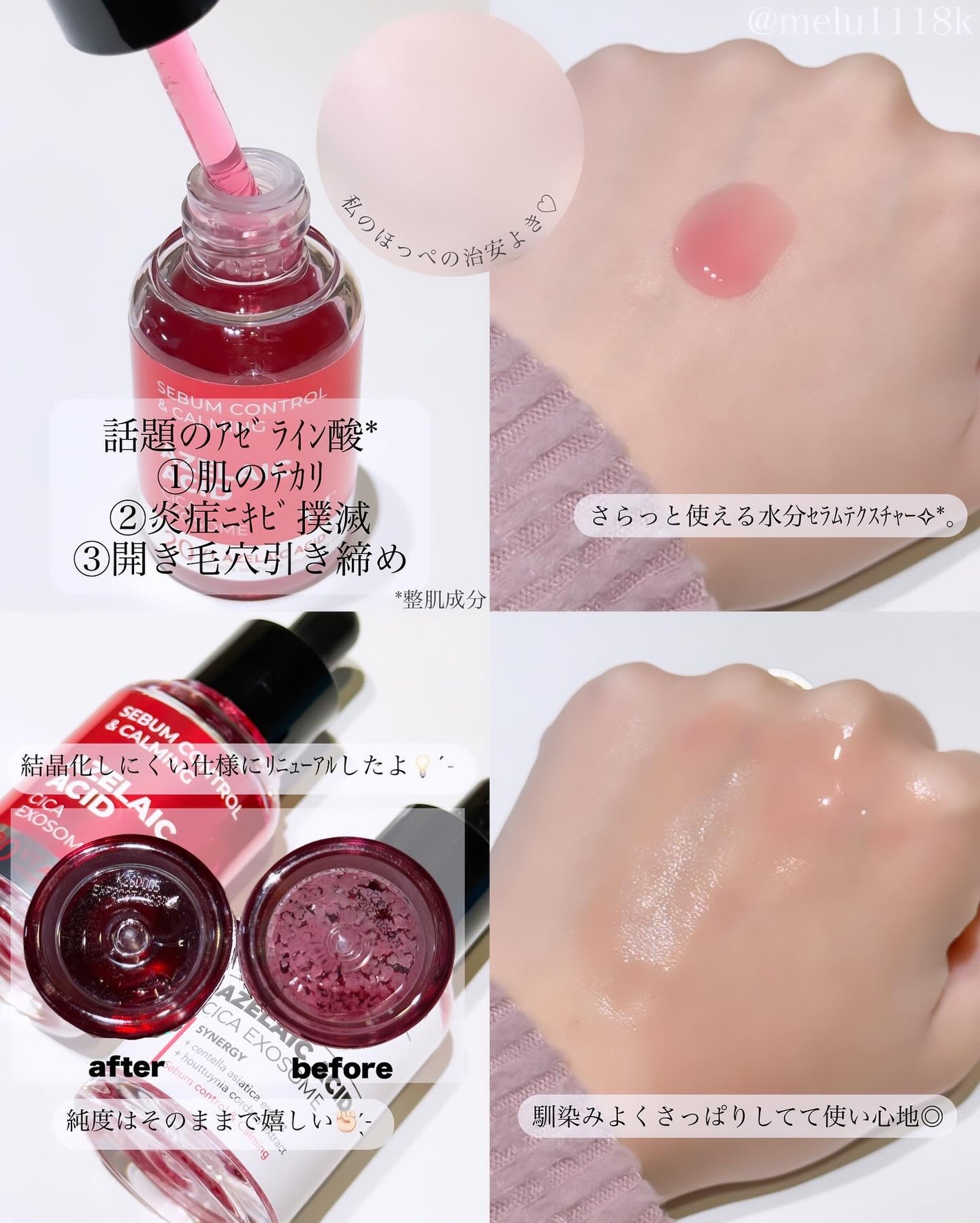 A1カーミング アンプル/VT/美容液を使ったクチコミ(2枚目)