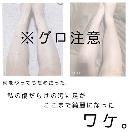 を使ったクチコミ(1枚目)