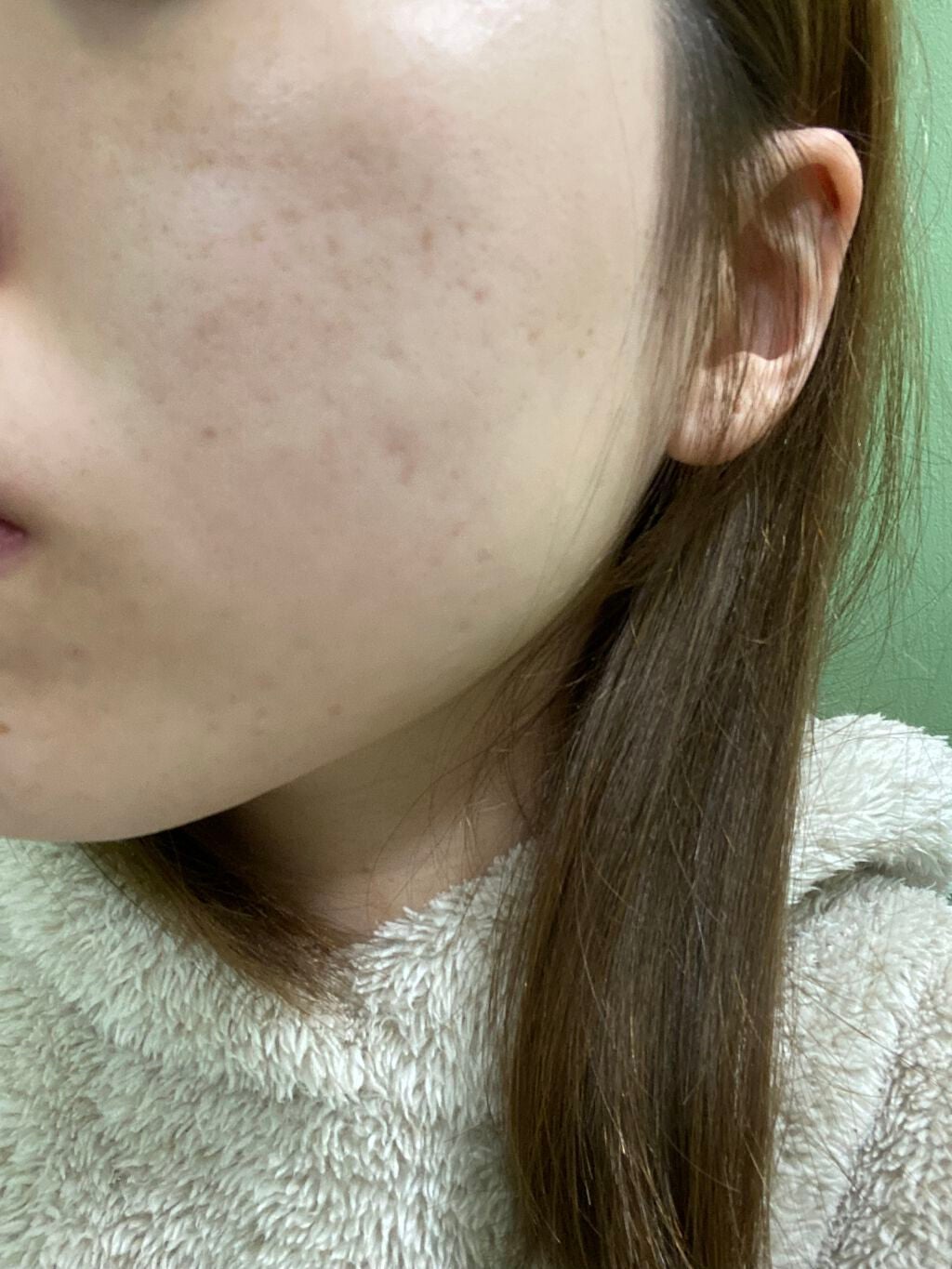 ホワイトニング エッセンス/アルージェ/美容液を使ったクチコミ(4枚目)