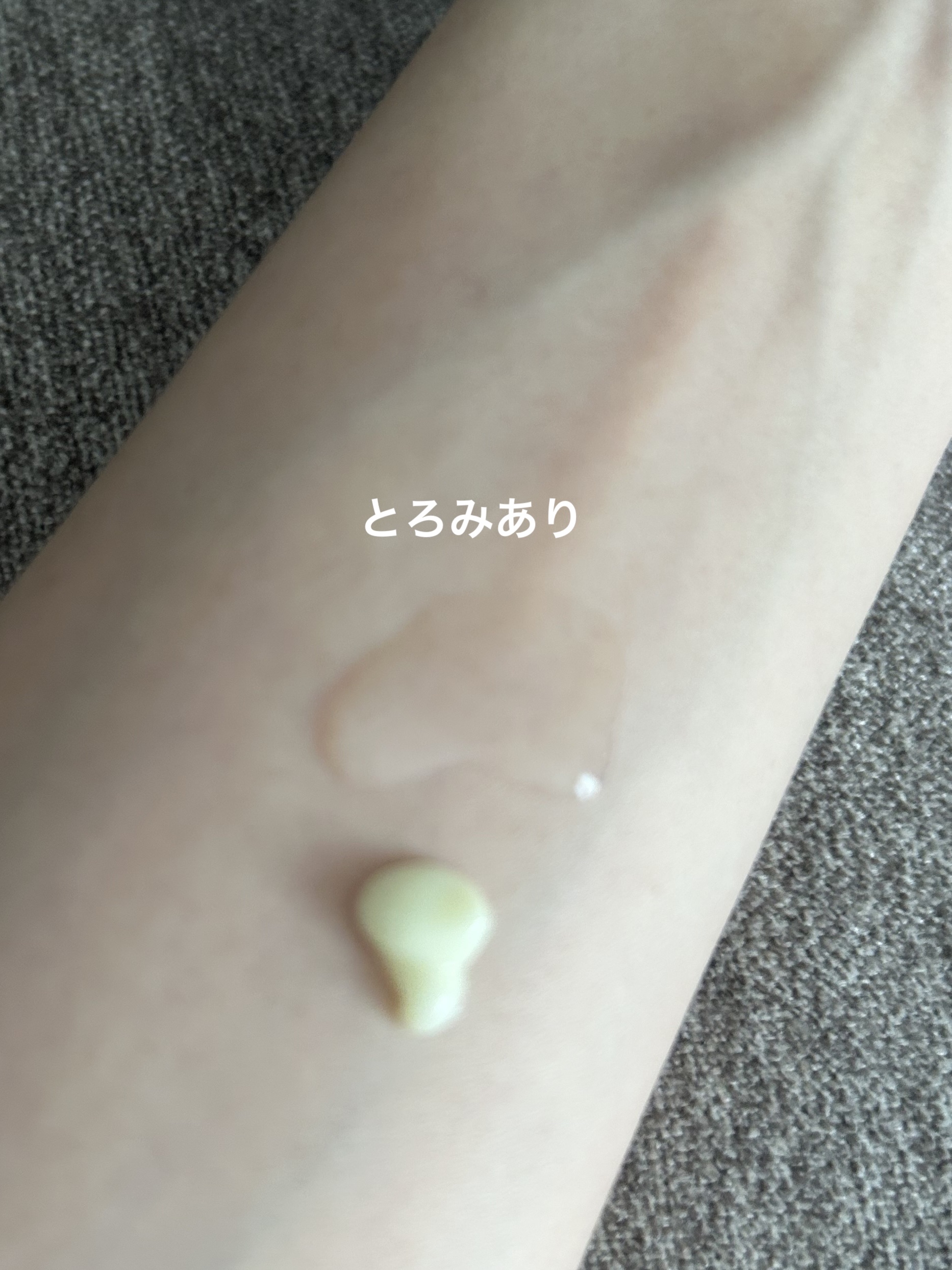 ヴィーガンリポソームレチノールセラム/SKIN&LAB/美容液を使ったクチコミ（3枚目）