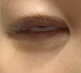 アイビューティー フィクサー WP/アストレア ヴィルゴ/二重まぶた用アイテムを使ったクチコミ（3枚目）