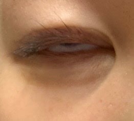 のびーるアイテープ(絆創膏タイプ、レギュラー)/DAISO/二重まぶた用アイテムを使ったクチコミ(3枚目)