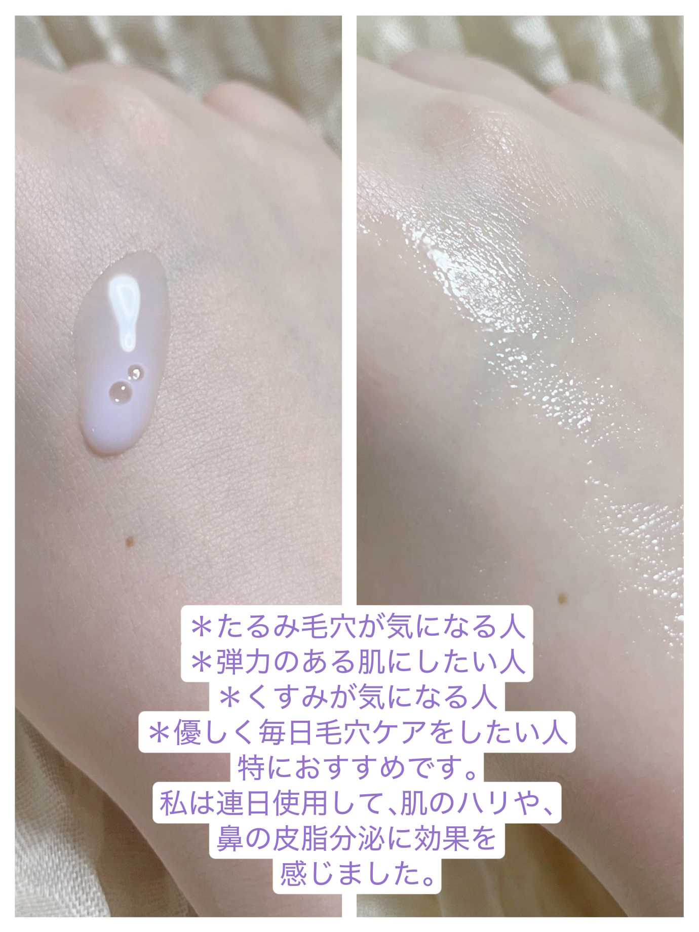 ポアスムージングバクチオールセラム/ByWishtrend/美容液を使ったクチコミ（3枚目）