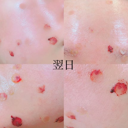 を使ったクチコミ(3枚目)