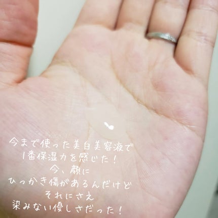 ミノン アミノモイスト 薬用マイルド ホワイトニング/ミノン/美容液を使ったクチコミ(2枚目)