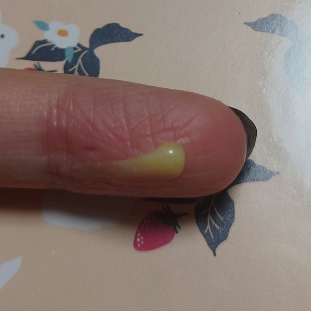 ユースキン/ユースキン/ボディクリームを使ったクチコミ(2枚目)