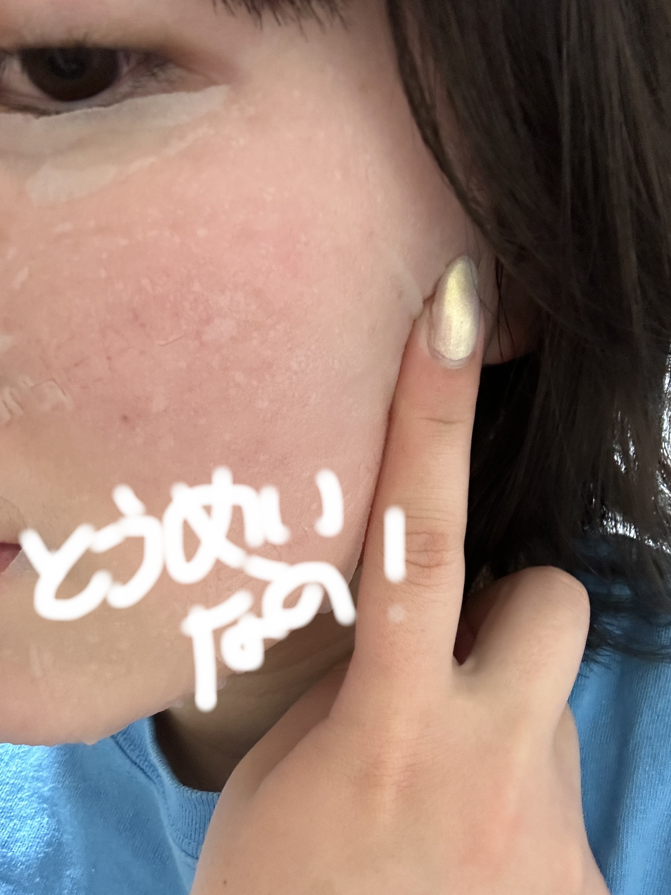 プラセンタ リバイタルエッセンシャルマスクEX/MEDIHEAL/シートマスク・パックを使ったクチコミ（3枚目）