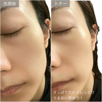 ビタミンブライトニングマスク/ONE THING/シートマスク・パックを使ったクチコミ(7枚目)