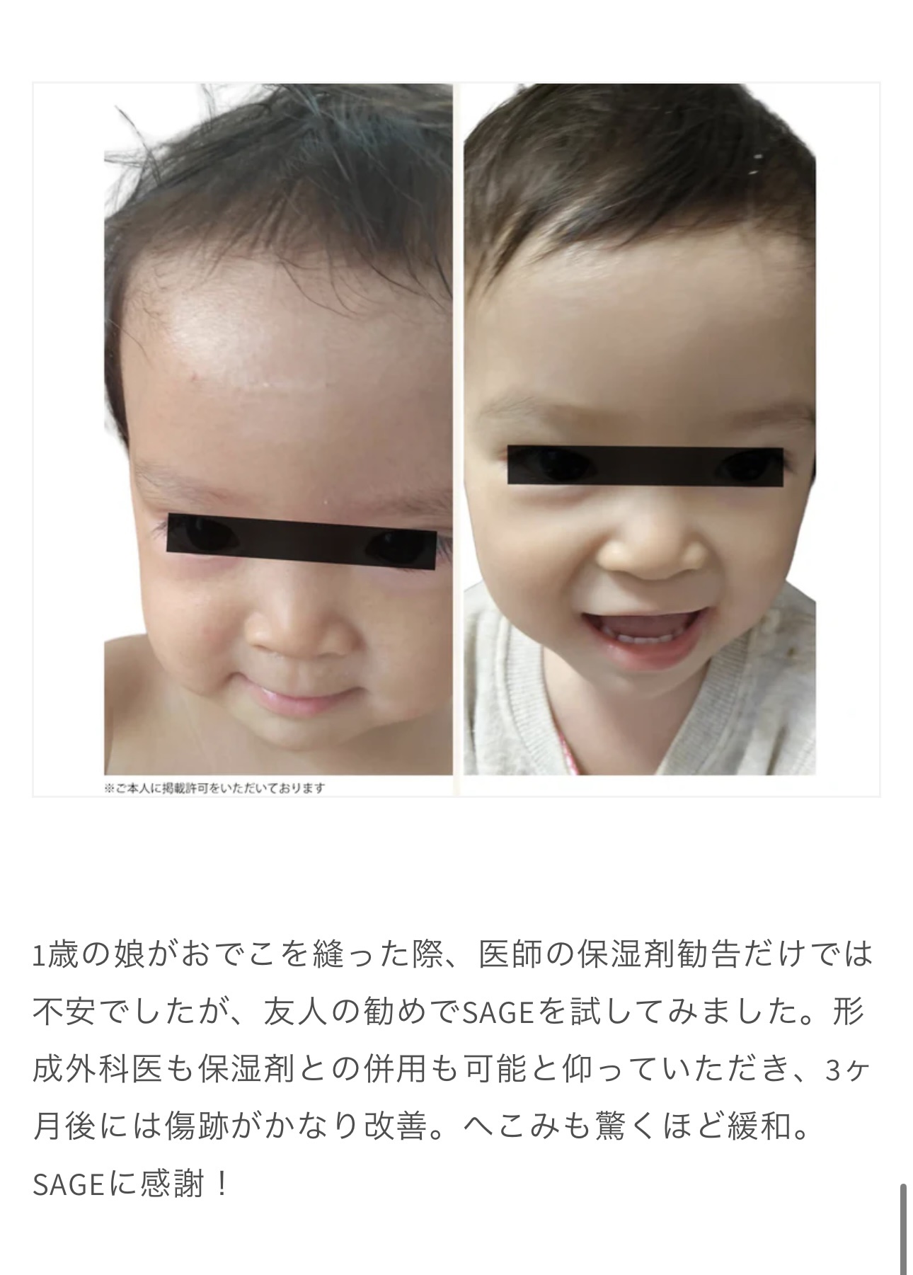 Sage Beauty Oil 皮膚科　ビフォーアフター :

Sage ビューティーブレンドはオメガ6＆9とポリフェノールを含むファイトケミカルが豊富に含まれ、強力な抗酸化作用があります。一年中輝く健康的な肌のための、完璧な抗酸化ブースタ