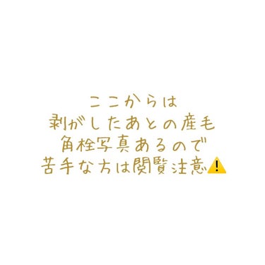 はちみーちゅ ピールオフパック/はちみーちゅ/洗い流すパック・マスクを使ったクチコミ（4枚目）