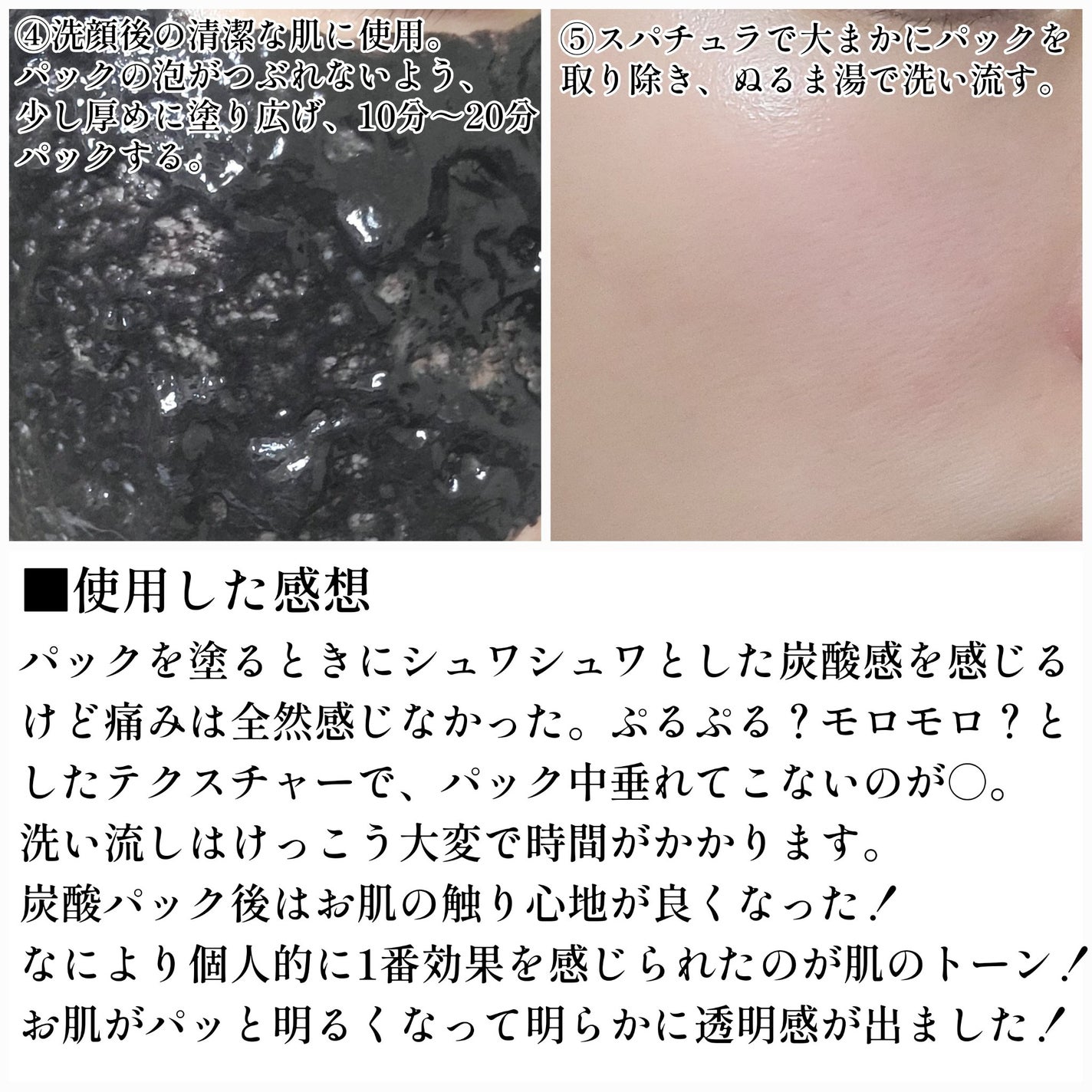 炭酸ジェルパック /KUROSECCA/洗い流すパック・マスクを使ったクチコミ(6枚目)