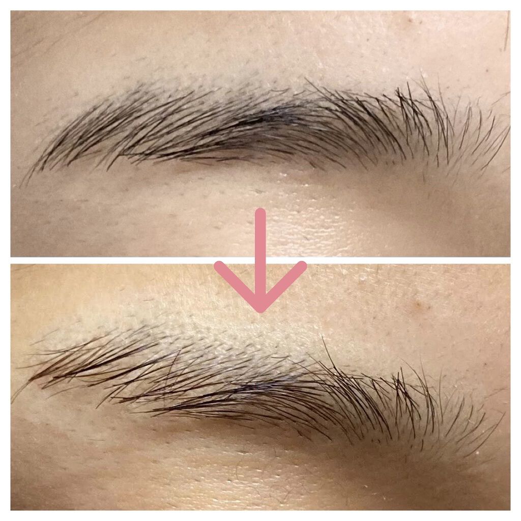 脱色クリーム 敏感肌用/エピラット/ムダ毛ケアを使ったクチコミ（1枚目）