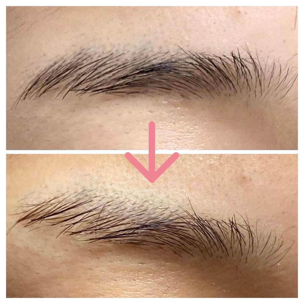 脱色クリーム 敏感肌用/エピラット/ムダ毛ケアを使ったクチコミ(1枚目)