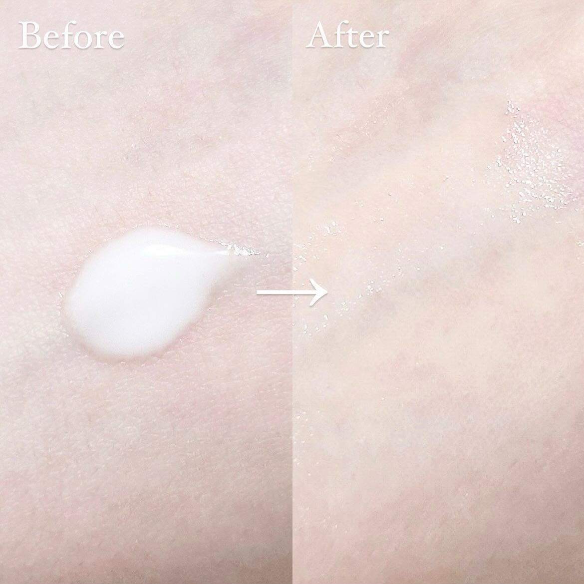 SOSメルダーシステム/KOPHER/フェイスクリームを使ったクチコミ（3枚目）