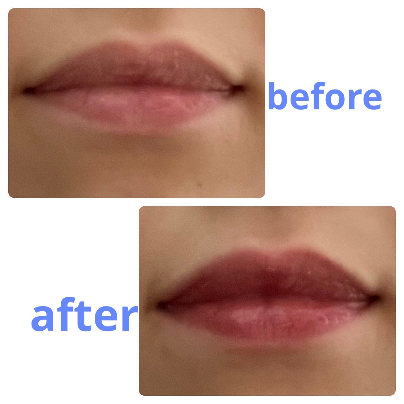 リップケア クリーム(美発色シリーズ)/キュレル/リップクリームを使ったクチコミ(3枚目)