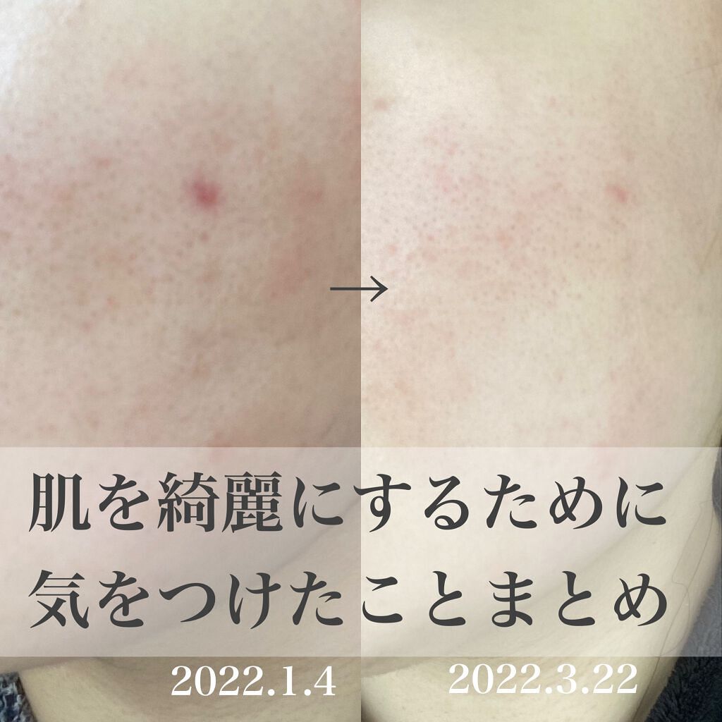 çŽã
ðžãã©ãã100(æçš¿ããæ¹) on LIPS ãèã綺éºã«ããããã«æ°ãã€ããããšãŸãšã2.5ã¶æéã®èãšã®æ Œ..ãïŒ1æç®ïŒ