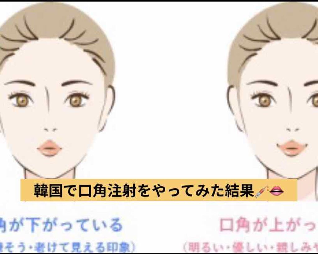 hiyoco フォロバ100 on LIPS 「私は3~4ヶ月に一度渡韓しては、韓国料理を食べつつ、プチメンテ..」(1枚目)