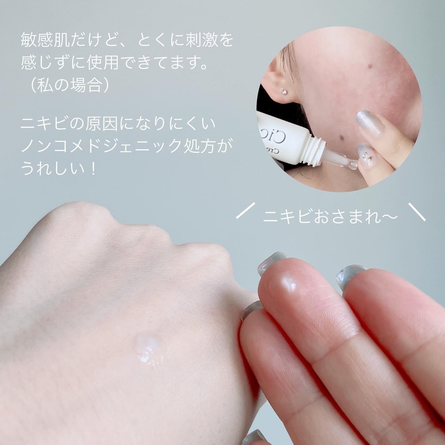 シカスポットクリーム/NATURAL DERMA PROJECT/フェイスクリームを使ったクチコミ(5枚目)