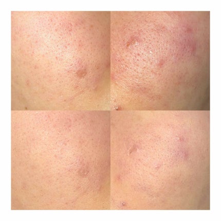 ビューティーフィルター ファンデーション/インテグレート/パウダーファンデーションを使ったクチコミ(1枚目)