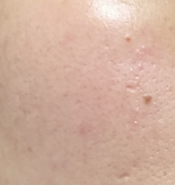 潤浸保湿 フェイスケアセット II しっとり/キュレル/トライアルキットを使ったクチコミ（3枚目）