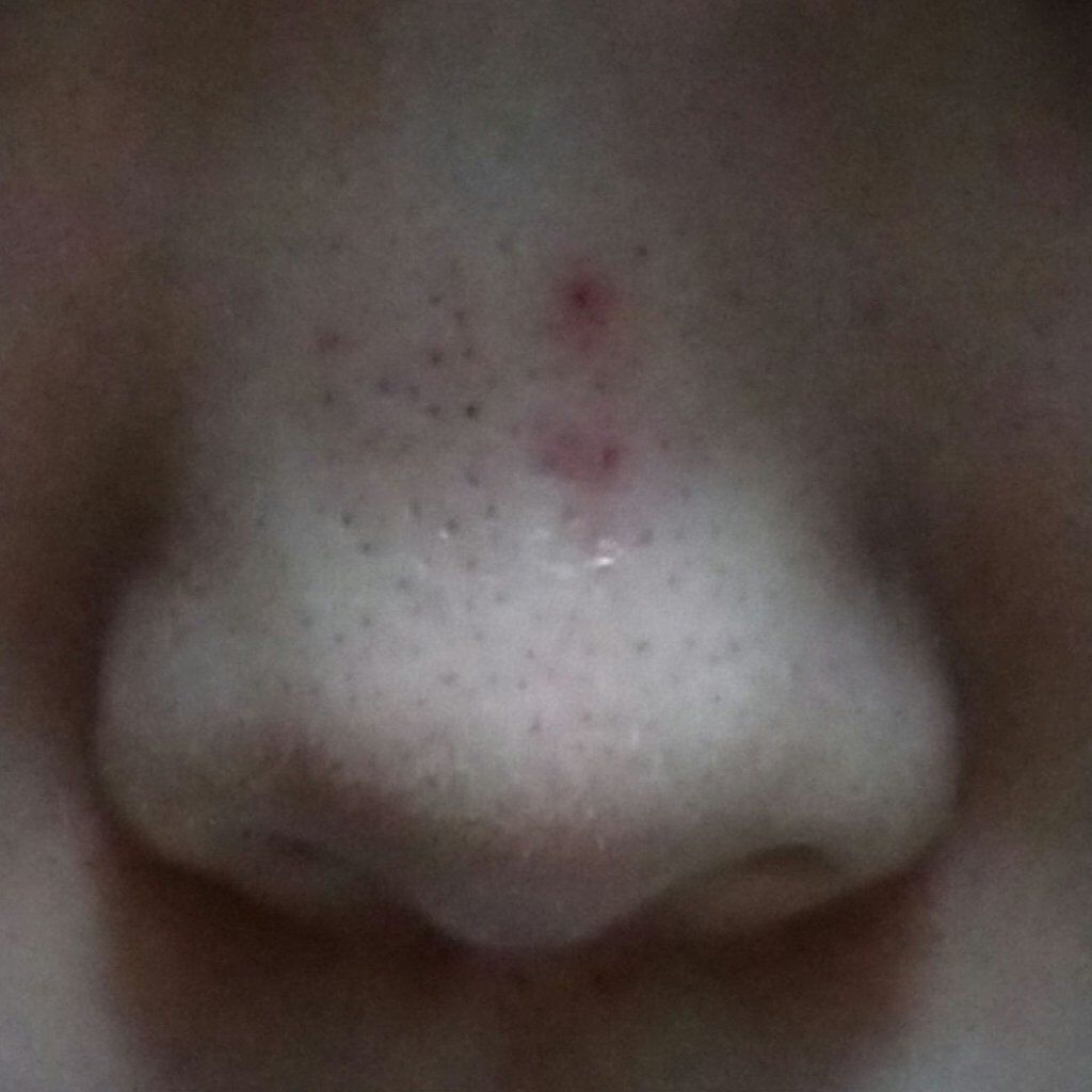 デュオ ザ クレンジングバーム クリア/DUO/クレンジングバームを使ったクチコミ（2枚目）