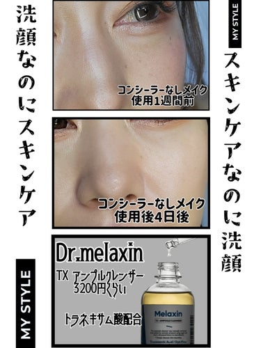 Dr.Melaxin TX-アンプルクレンザーのクチコミ「美容液成分で顔を洗う。
古い角質や老廃物を優しい泡で流しながら、ぐんぐんと美容液成分を吸収させ.....」（3枚目）