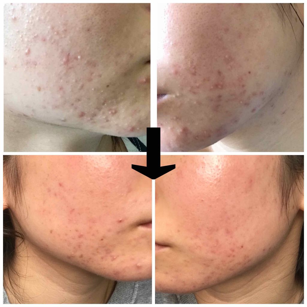 化粧水・敏感肌用・しっとりタイプ/無印良品/化粧水を使ったクチコミ（2枚目）